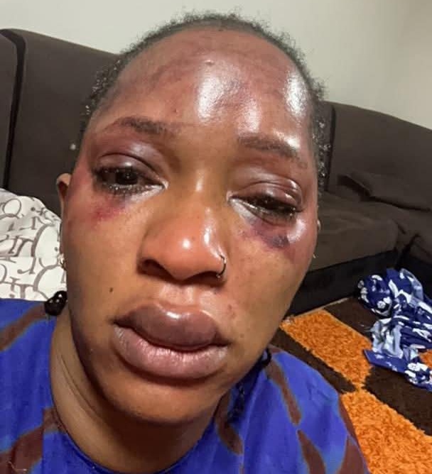 Violence conjugale : Djelikaba sort enfin du silence et dénonce, "Pervers narcissique trop c’est trop !"